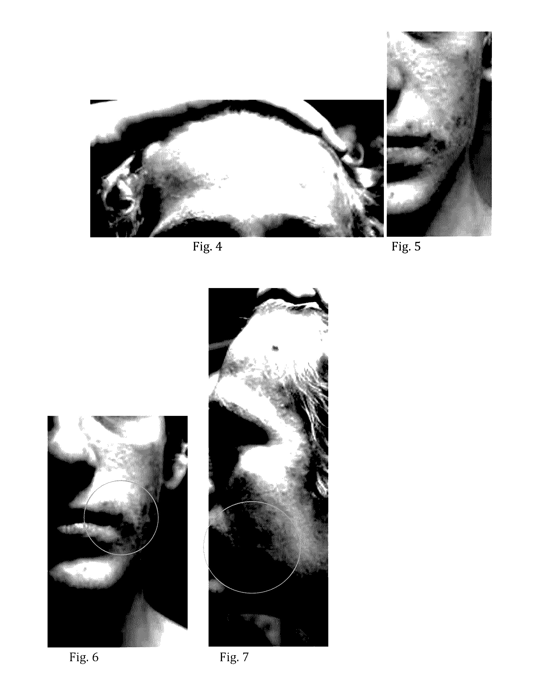 Chlorite-Containing Compositions