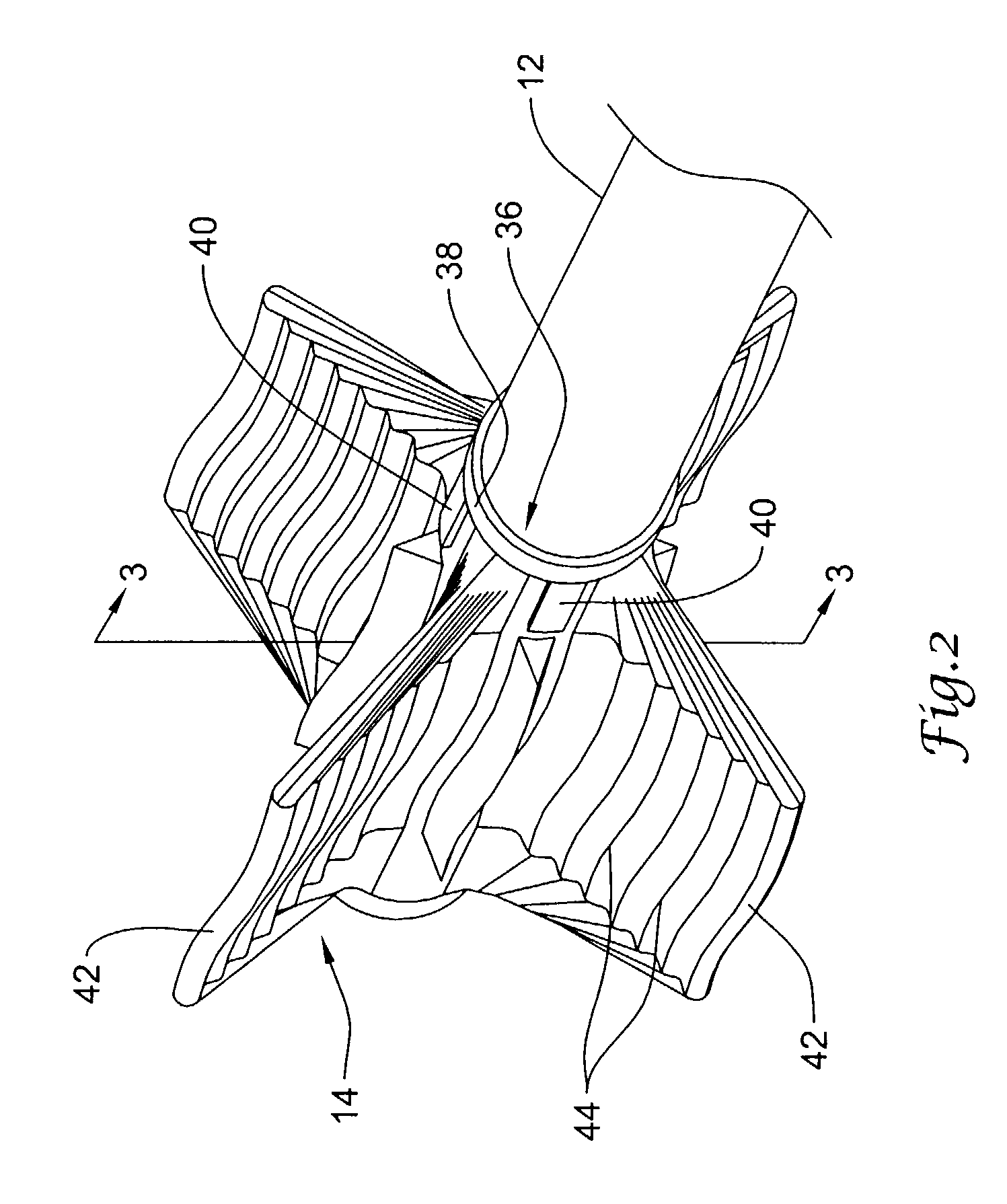 Cutting balloon catheter with improved balloon configuration