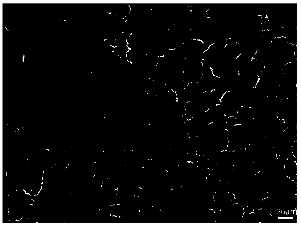 Elastic gel support material for bone tissue engineering and preparation method of material