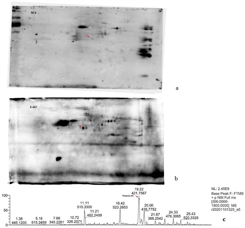 A test kit for detecting anti-prelamin A/C-IgG antibody