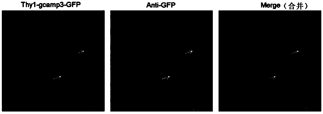 Treatment liquid composition, treatment liquid kit and method for simultaneous biological organ transparentizing and immunolabeling