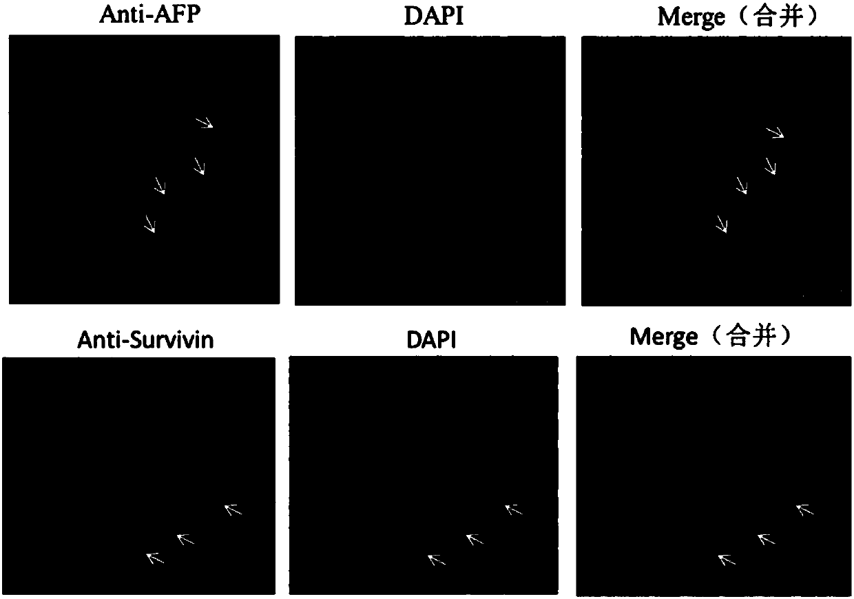 Treatment liquid composition, treatment liquid kit and method for simultaneous biological organ transparentizing and immunolabeling