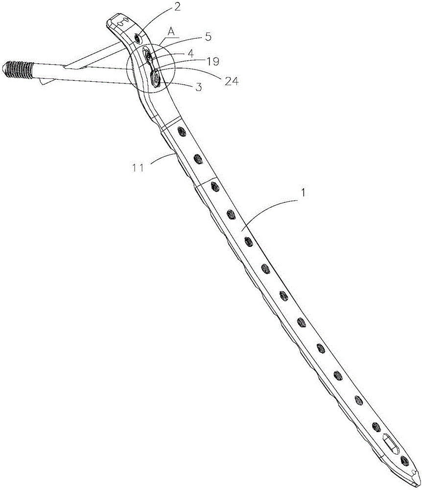 Fixing structure of positioning locking steel plate for proximal femur