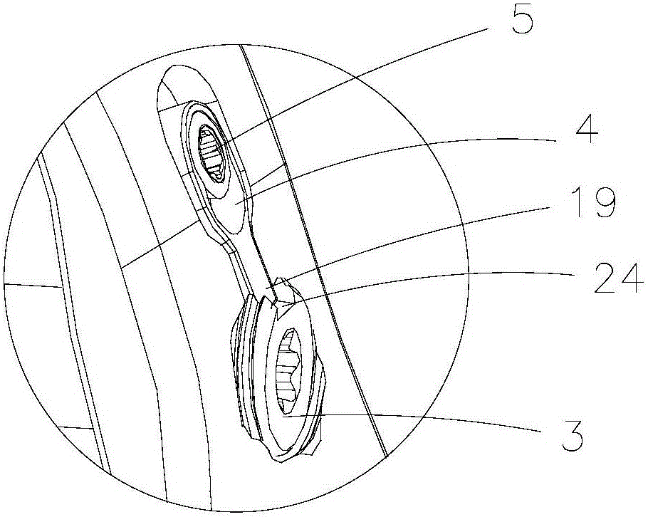 Fixing structure of positioning locking steel plate for proximal femur