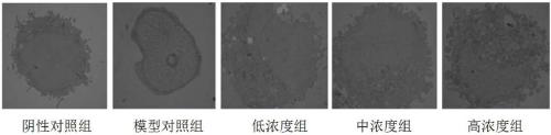 Application of traditional Chinese medicine composition containing radix astragali in regulating and controlling gastric cancer immune microenvironment