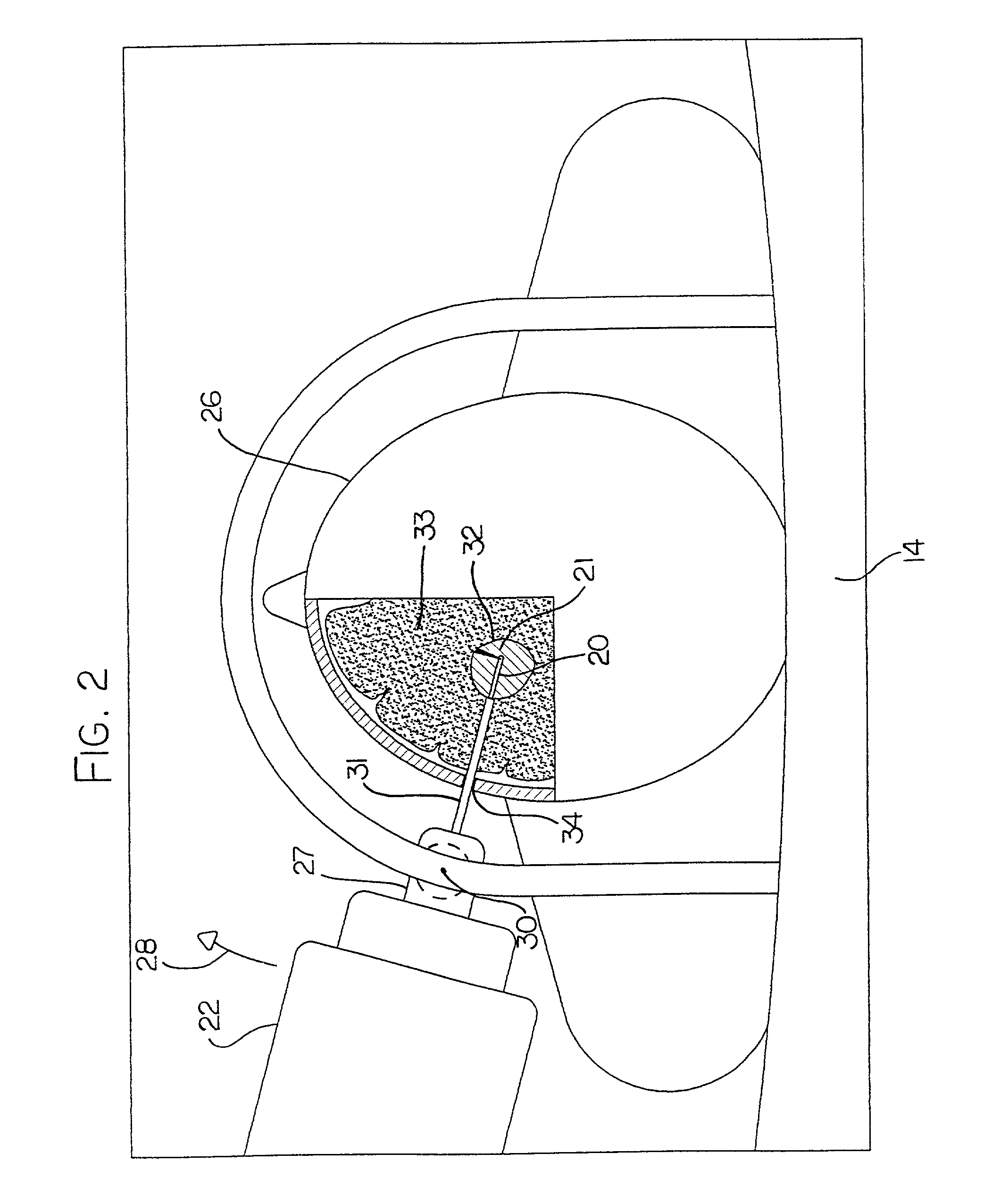 Hyperthermia treatment and probe therefor