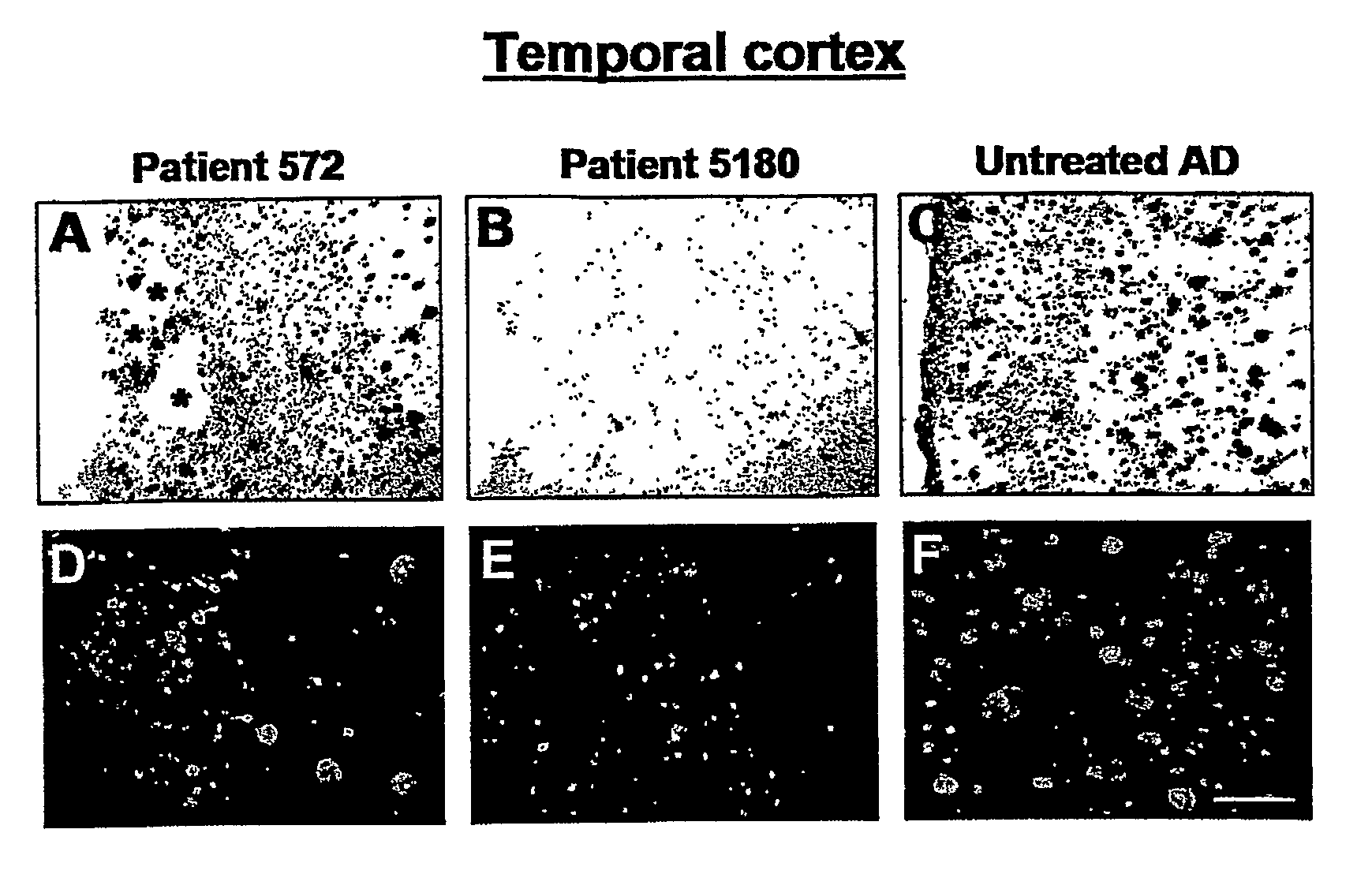 Amyloid Imaging as a Surrogate Marker for Efficacy of Anti-Amyloid Therapies