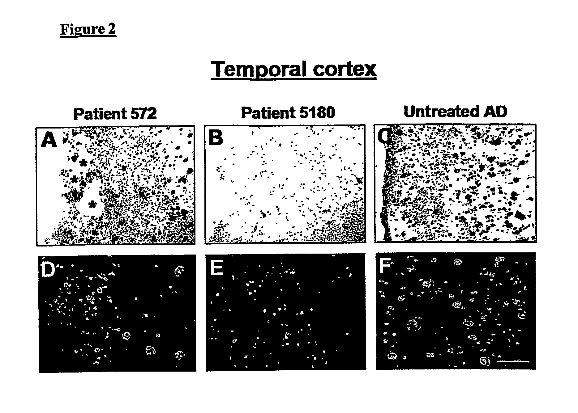 Amyloid Imaging as a Surrogate Marker for Efficacy of Anti-Amyloid Therapies