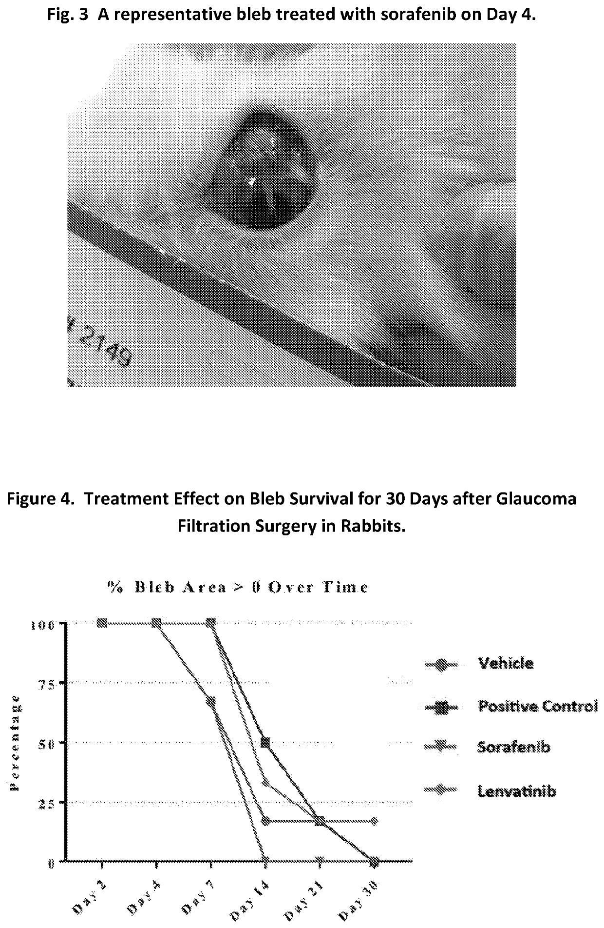 Multikinase inhibitors and uses in ocular fibrosis