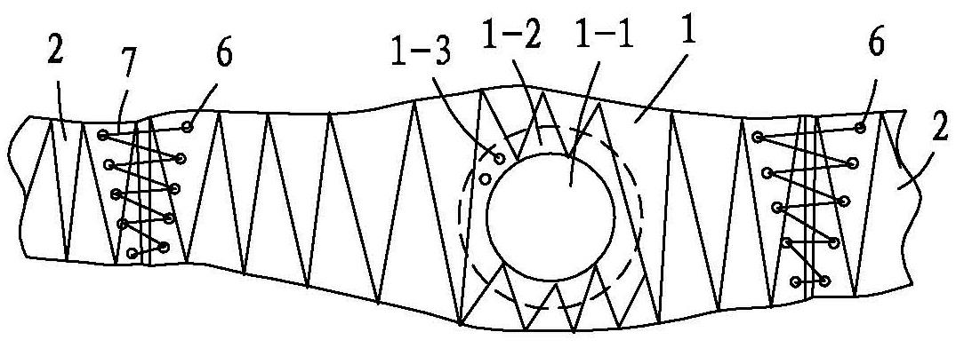 Enterostomy abdominal belt