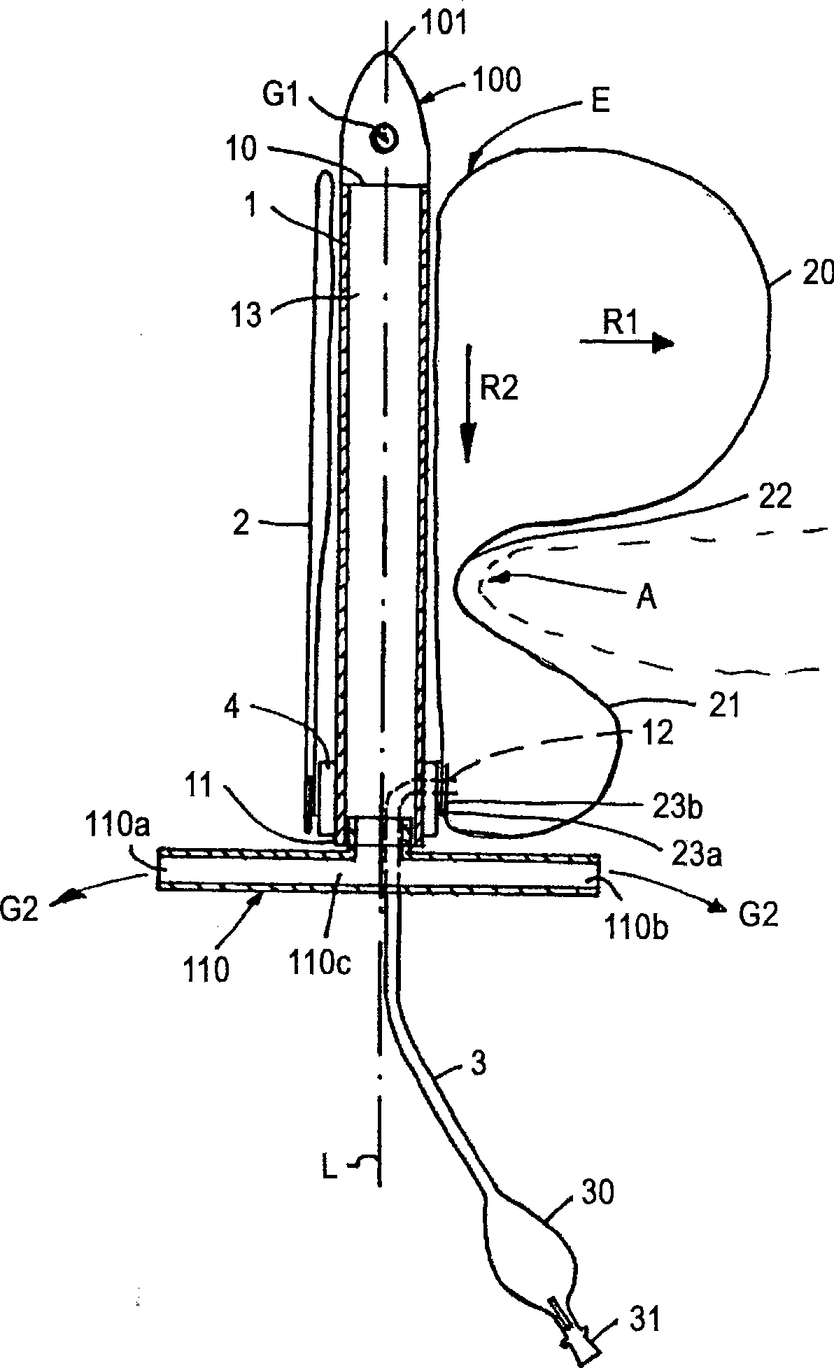 Occlusion system for management of rectal or anal incontinence