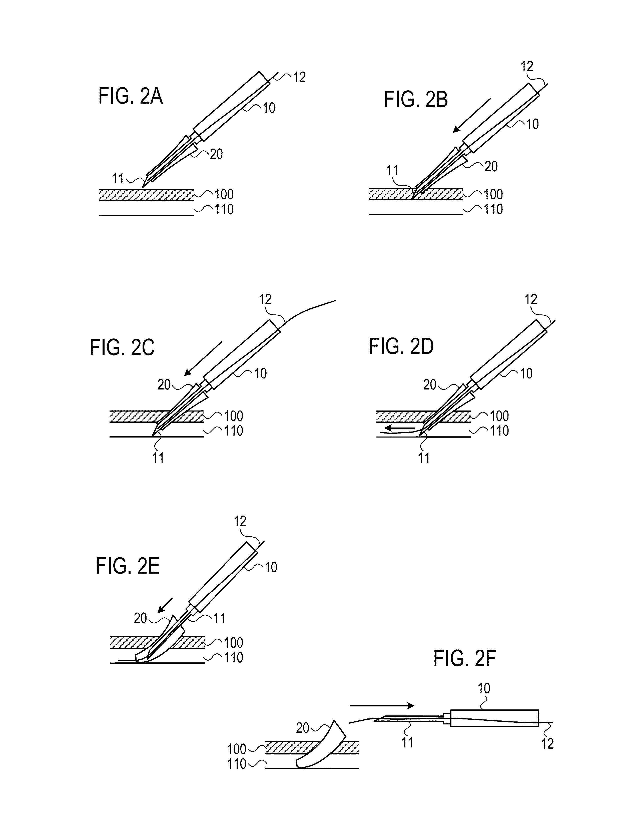 Devices and methods for endovascular access and therapy