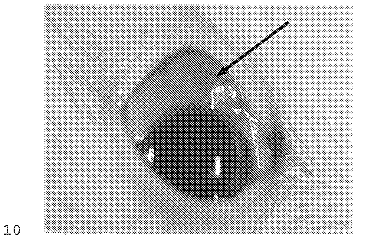 Drug delivery systems and methods for treating neovascularization