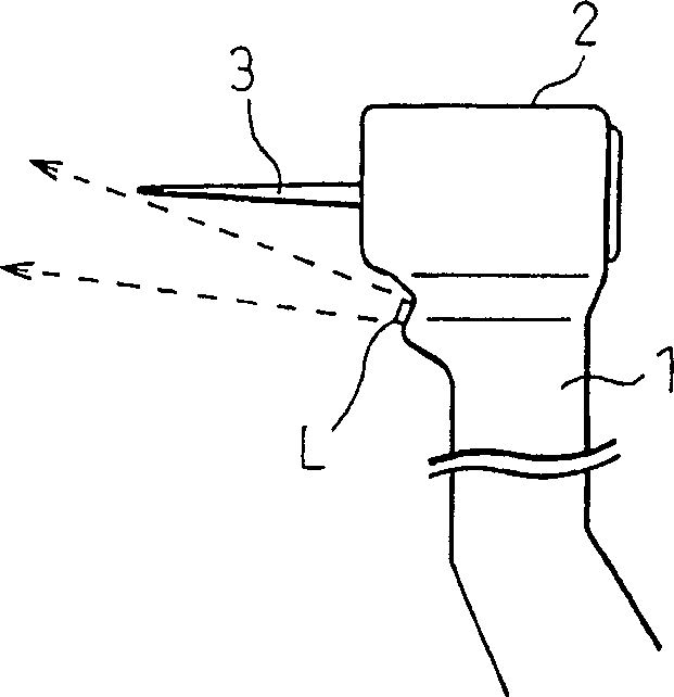 Dental diagnostic device