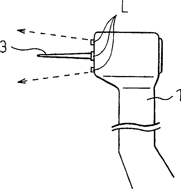 Dental diagnostic device