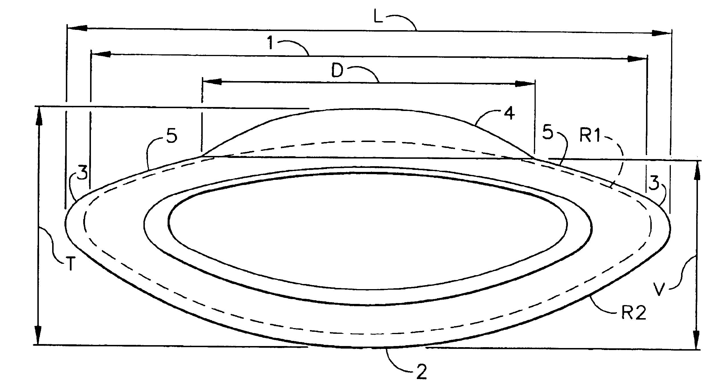 Accommodative intraocular lens