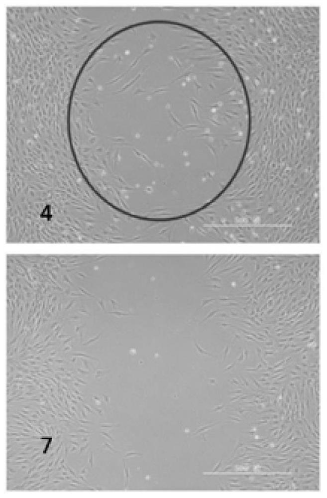 A method for preparing seaweed fermentation liquid by probiotic fermentation and application of the seaweed fermentation liquid in cosmetics