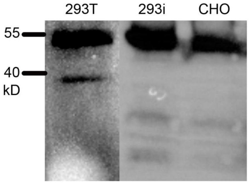 Nano vaccine taking SARS-CoV-2 virus S protein RBD region as antigen and preparation method of nano vaccine