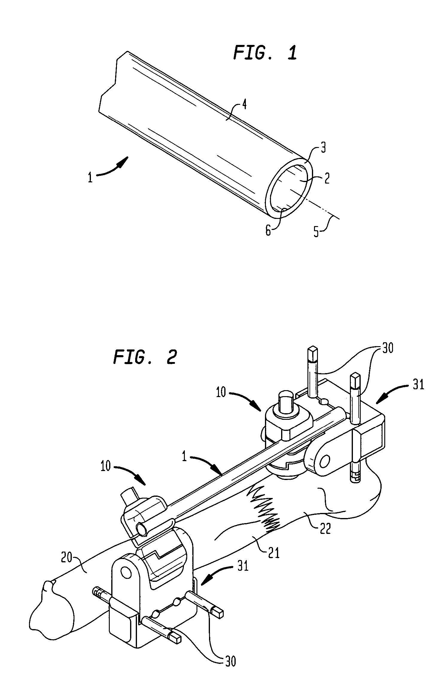 External fixation element