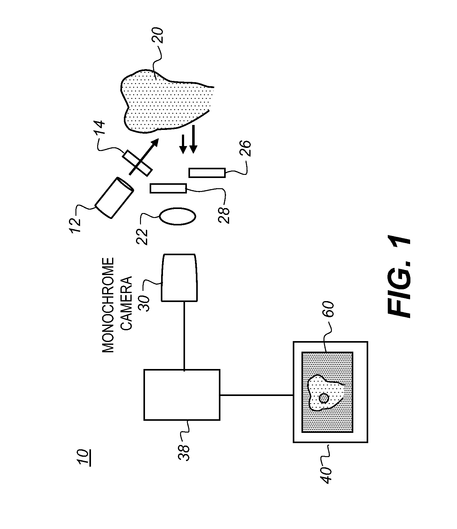 Method and apparatus for detection of caries