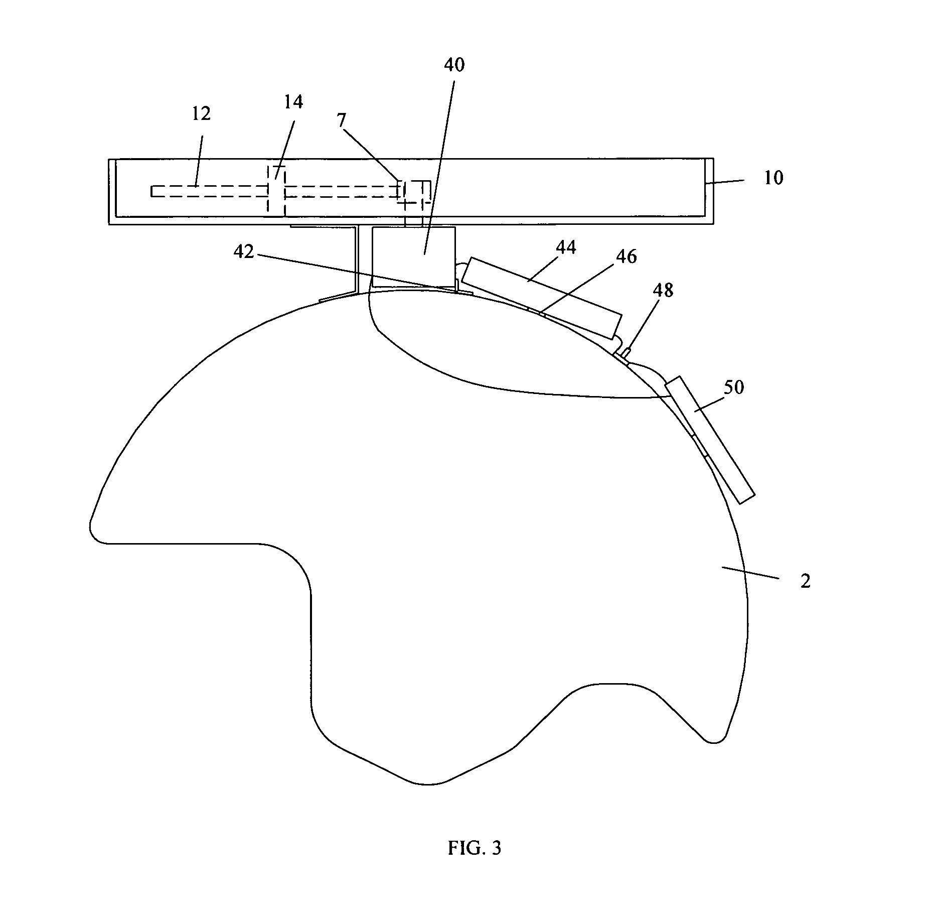 Neck exercise and rehabilitation device