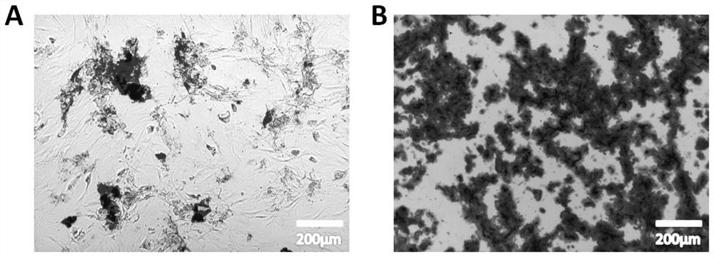 Application of rhodiola rosea and salidroside in the directed differentiation of stem cells into cardiomyocyte-like cells