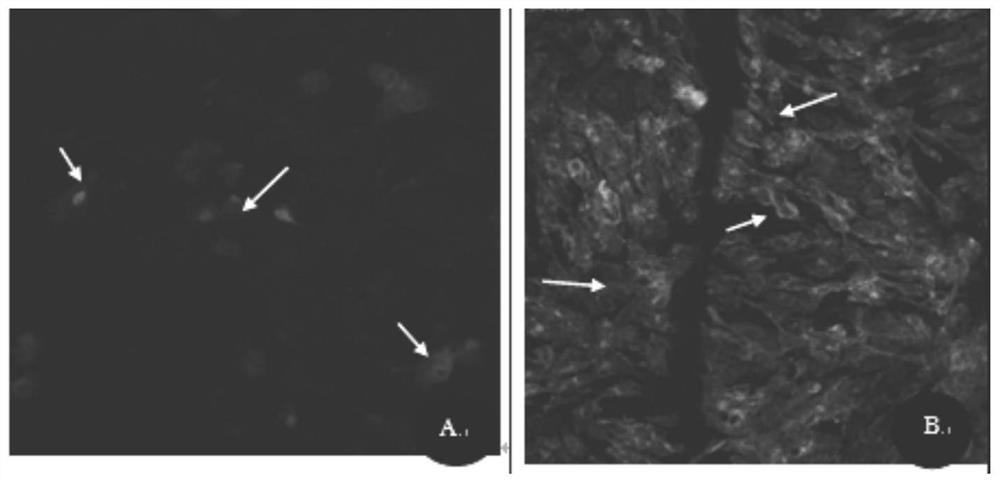 Application of rhodiola rosea and salidroside in the directed differentiation of stem cells into cardiomyocyte-like cells