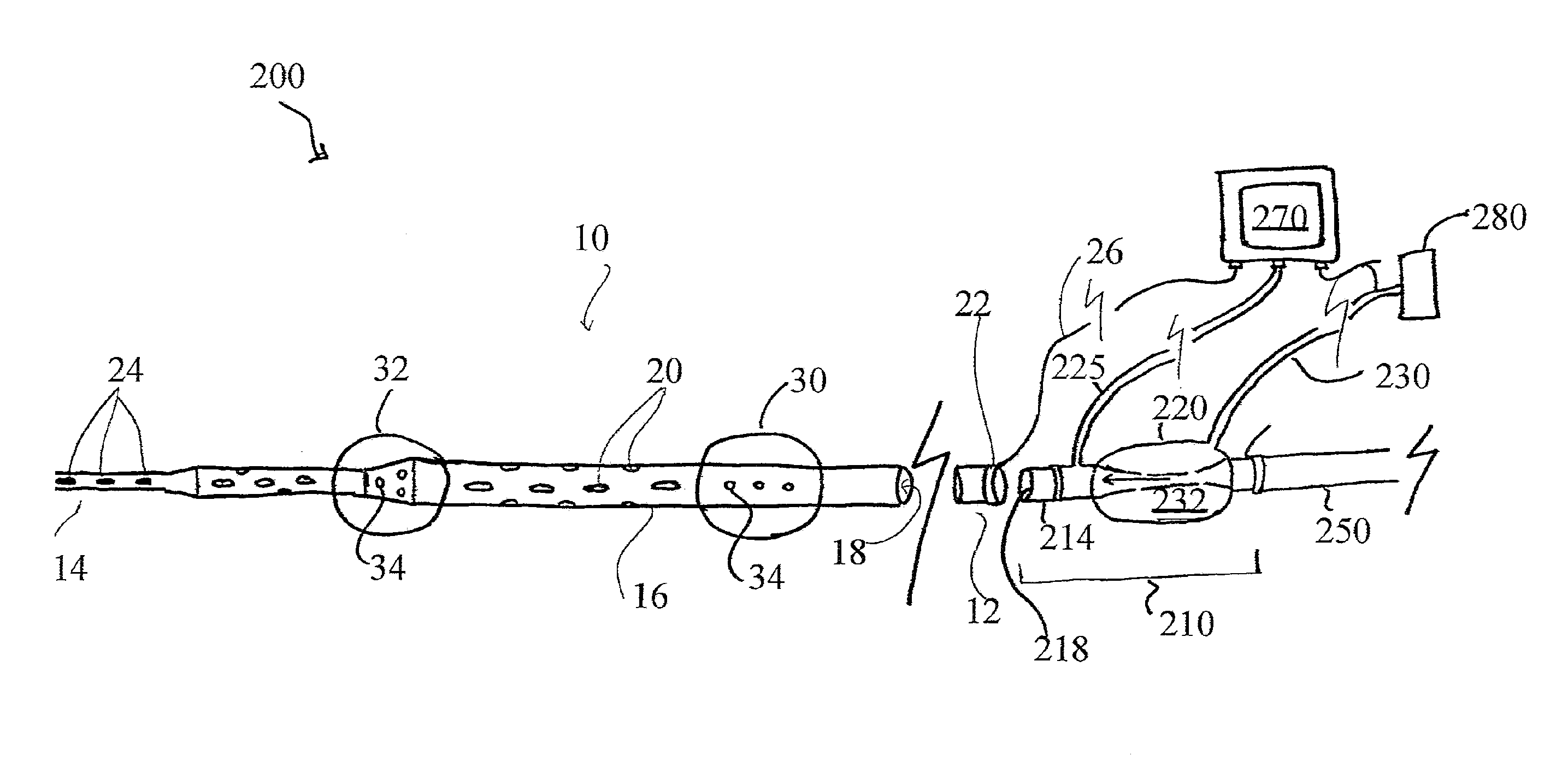 Systems and methods for selective auto-retroperfusion along with regional mild hypothermia