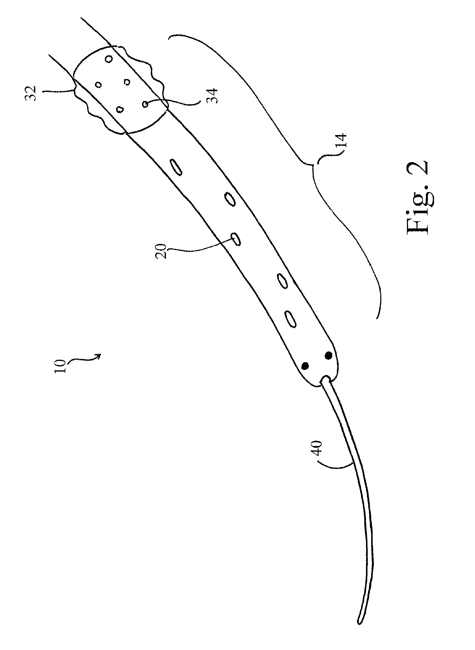 Systems and methods for selective auto-retroperfusion along with regional mild hypothermia