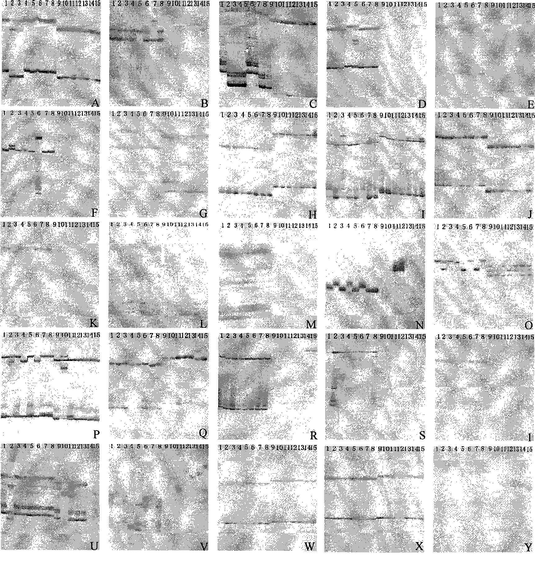 Method for identifying celery cabbage-brassica oleracea alien addition lines