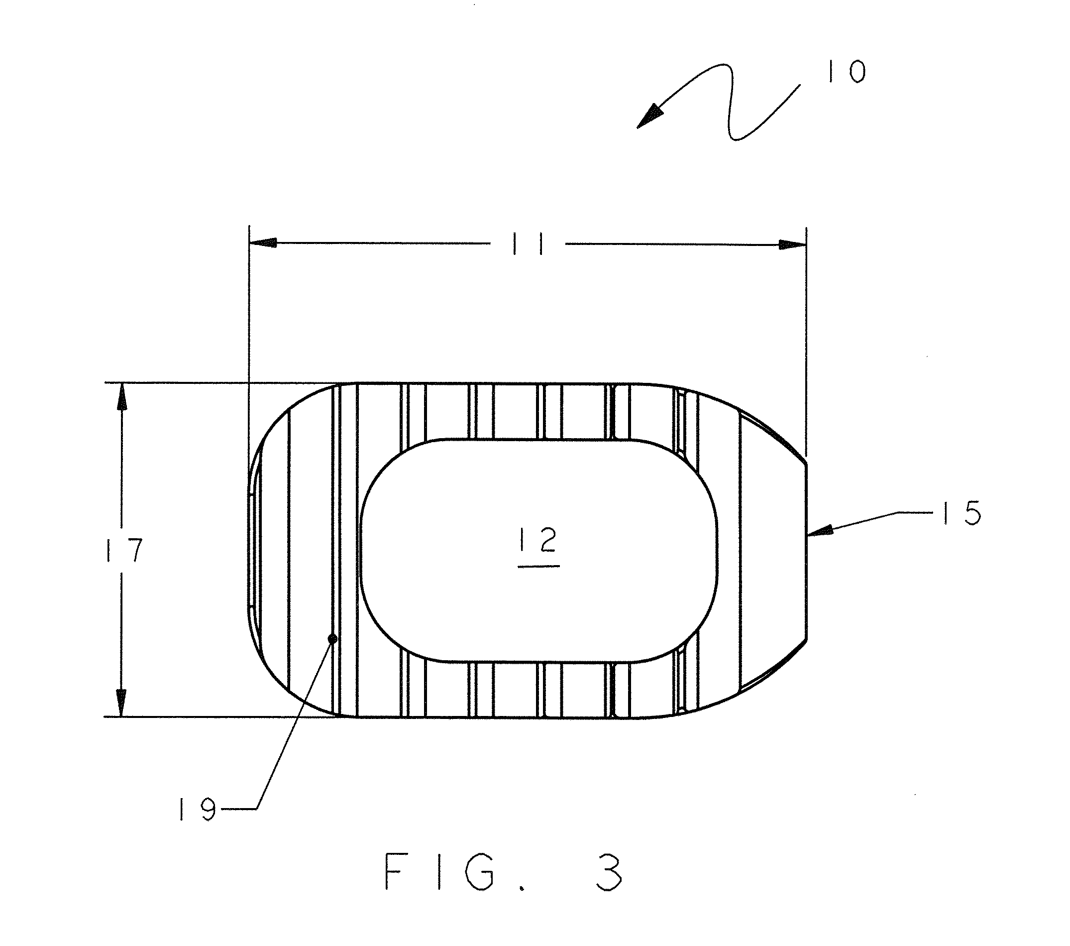 In-situ formed spinal implant