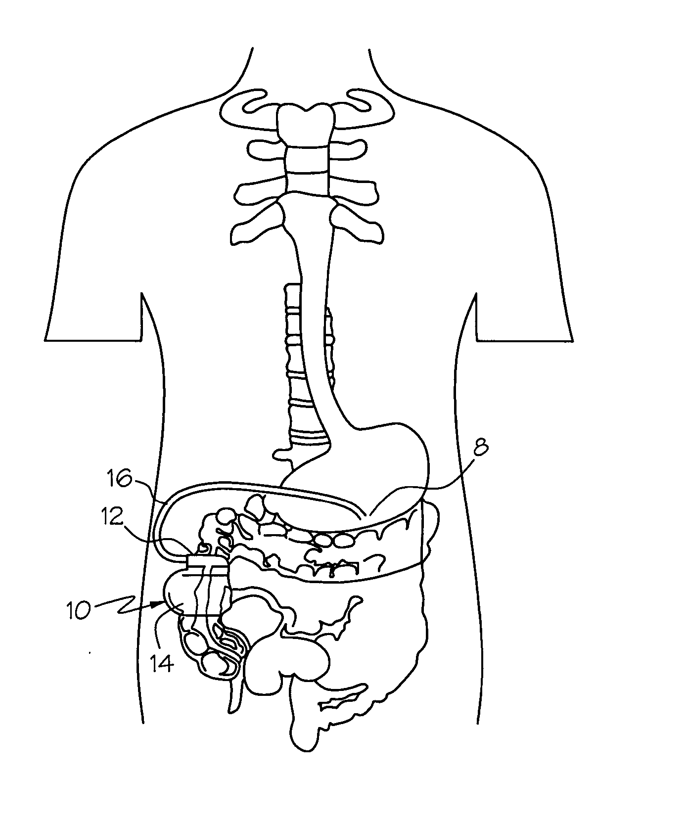 Heart rate variability control of gastric electrical stimulator