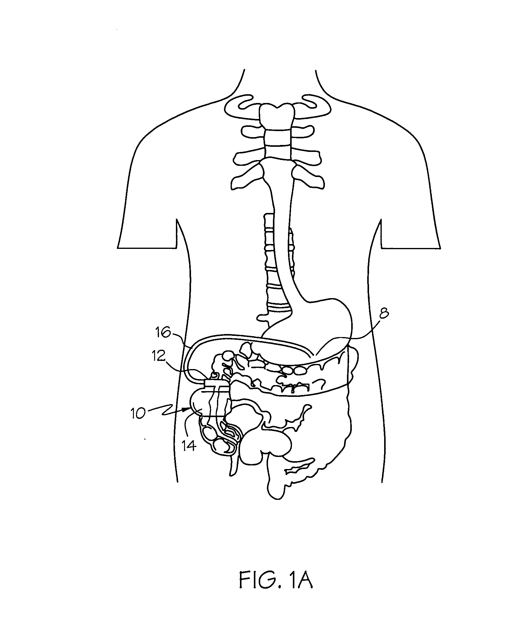 Heart rate variability control of gastric electrical stimulator