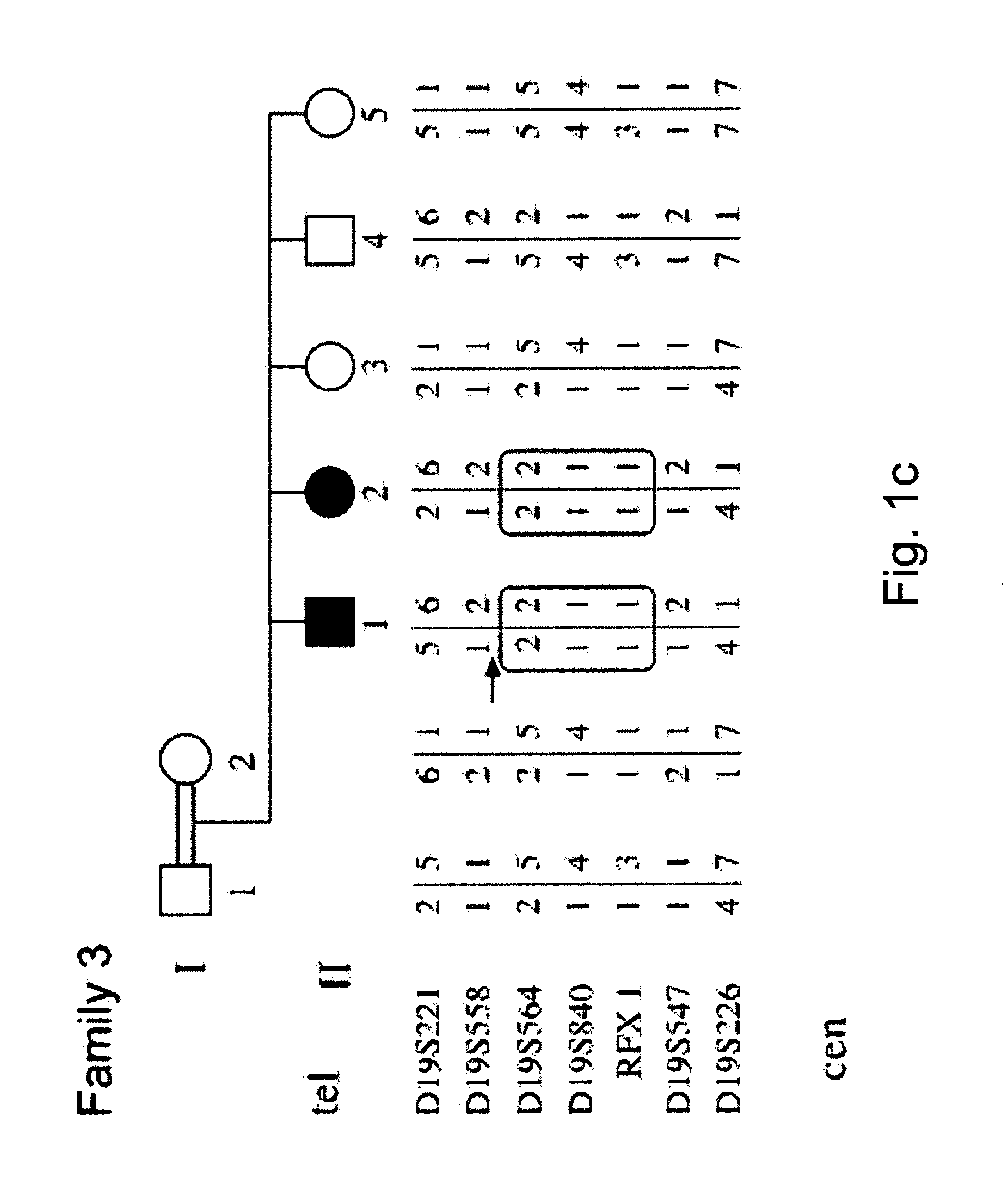 Methods and kits for diagnosing and treating mental retardation