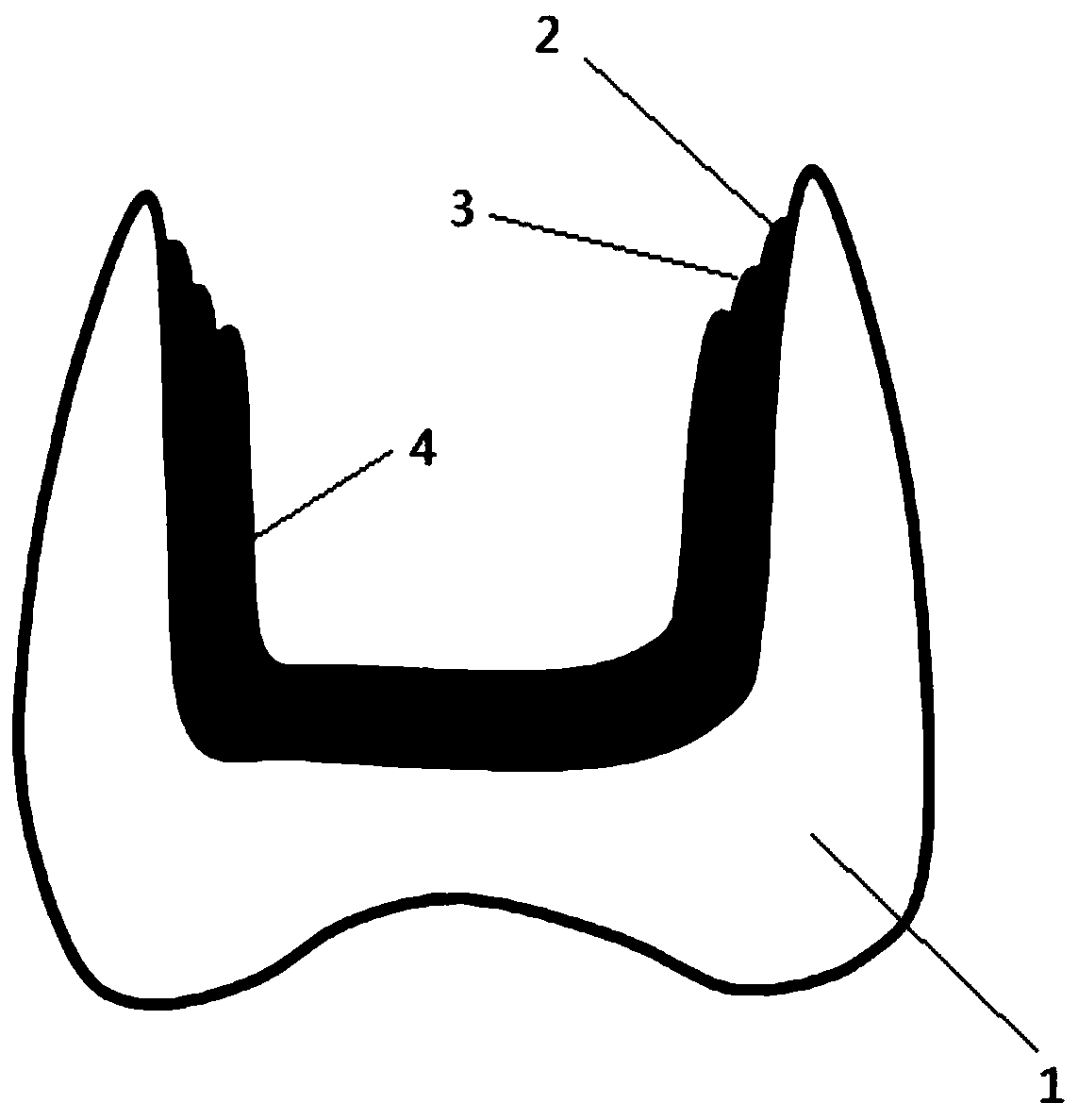 Masking zirconium oxide restoration