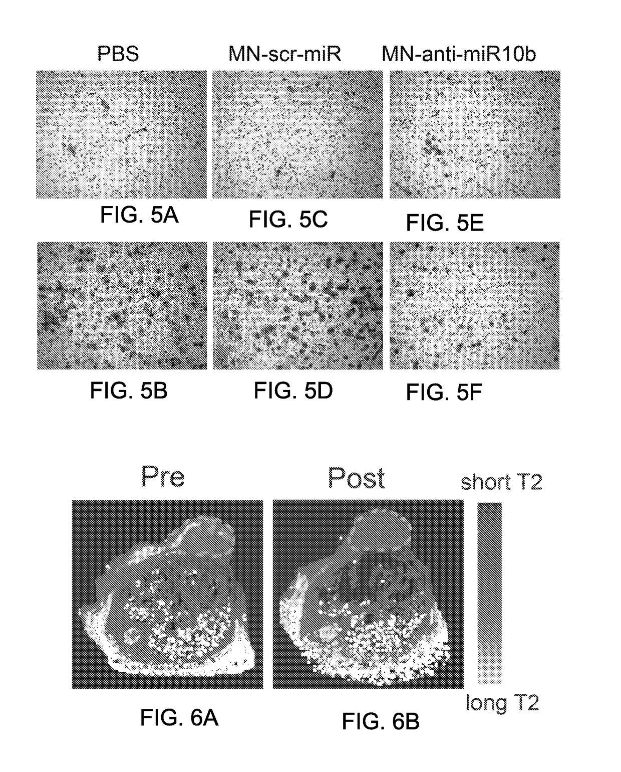 Therapeutic nanoparticles and methods of use thereof