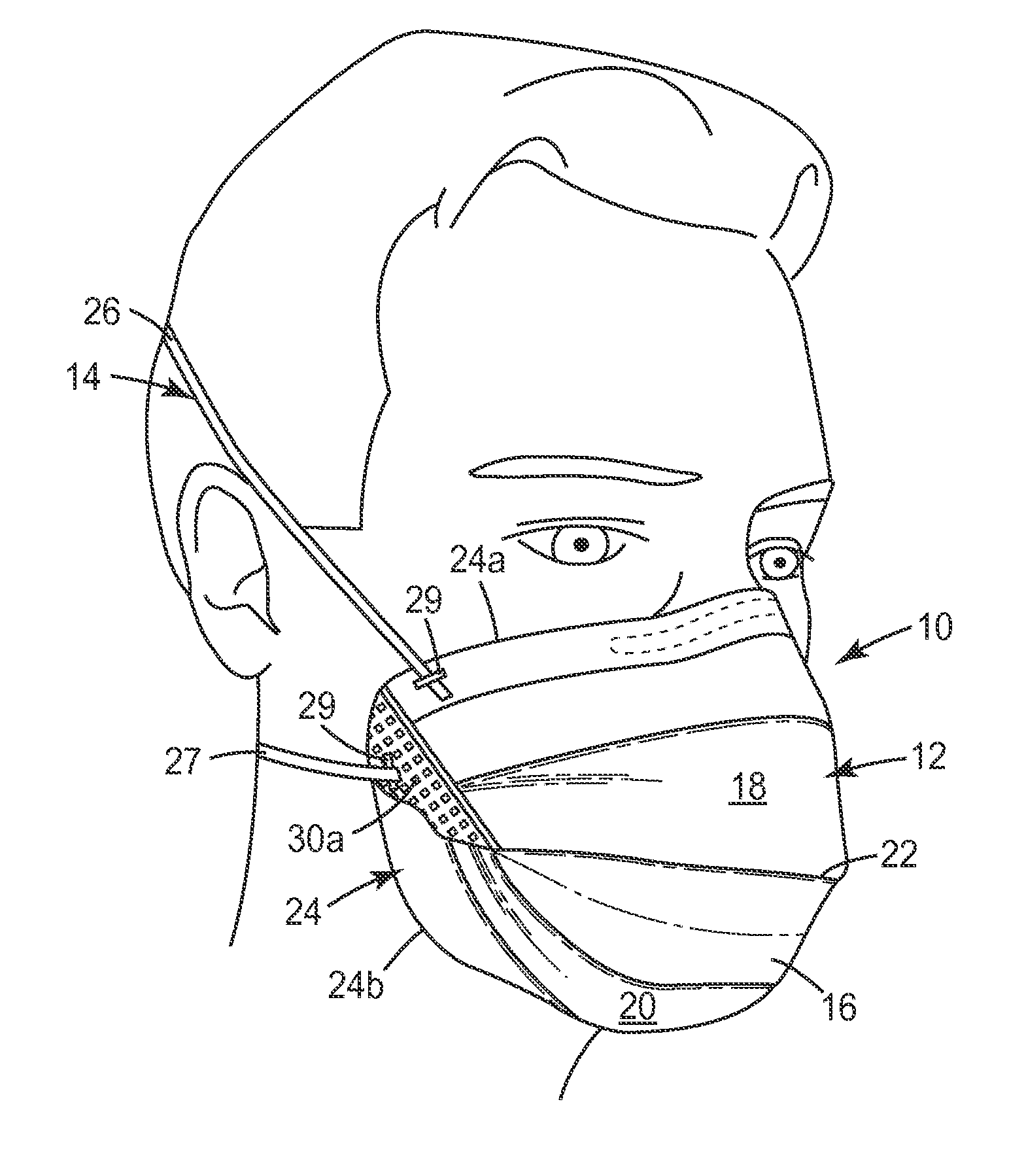 Filtering face-piece respirator having nose cushioning member