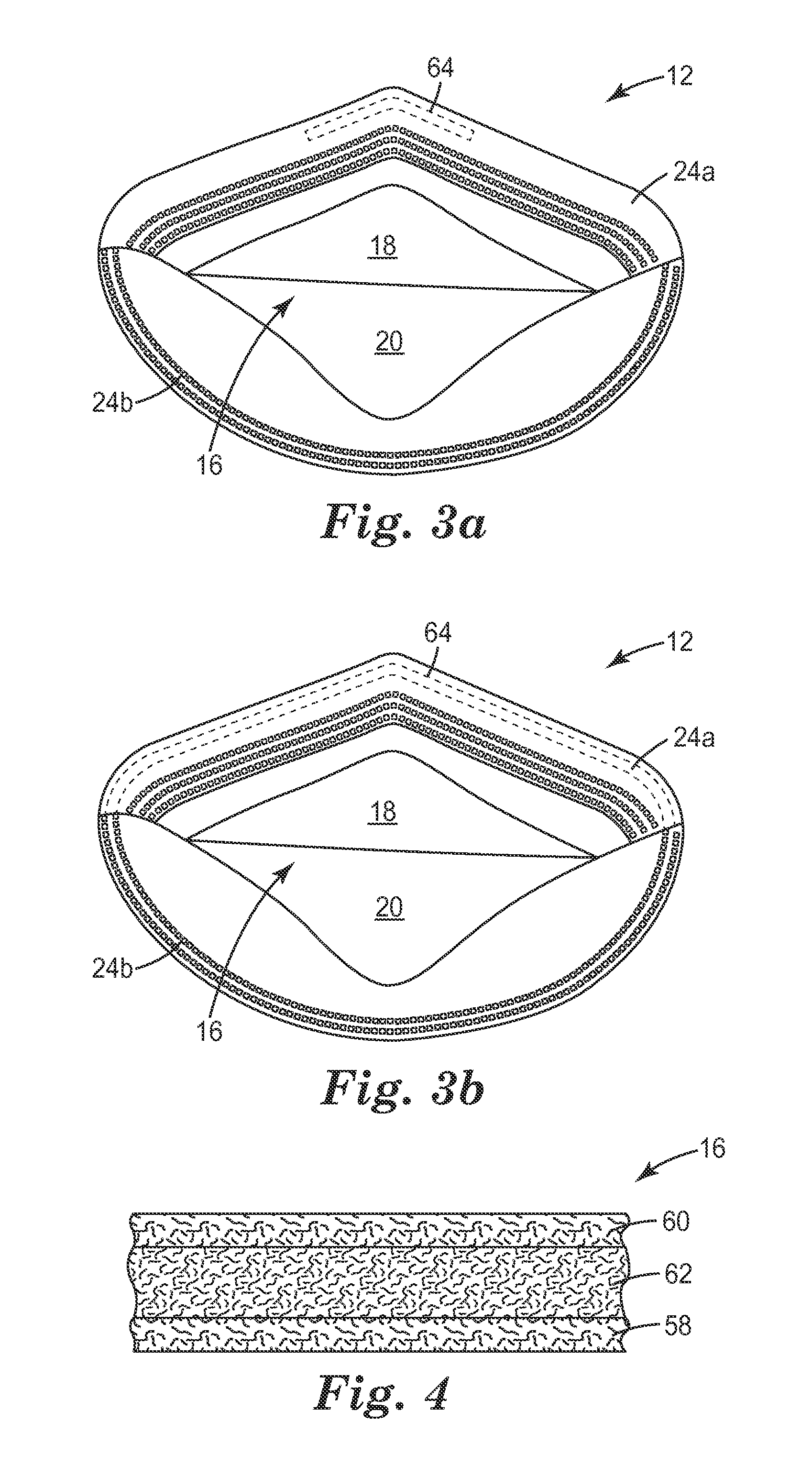 Filtering face-piece respirator having nose cushioning member