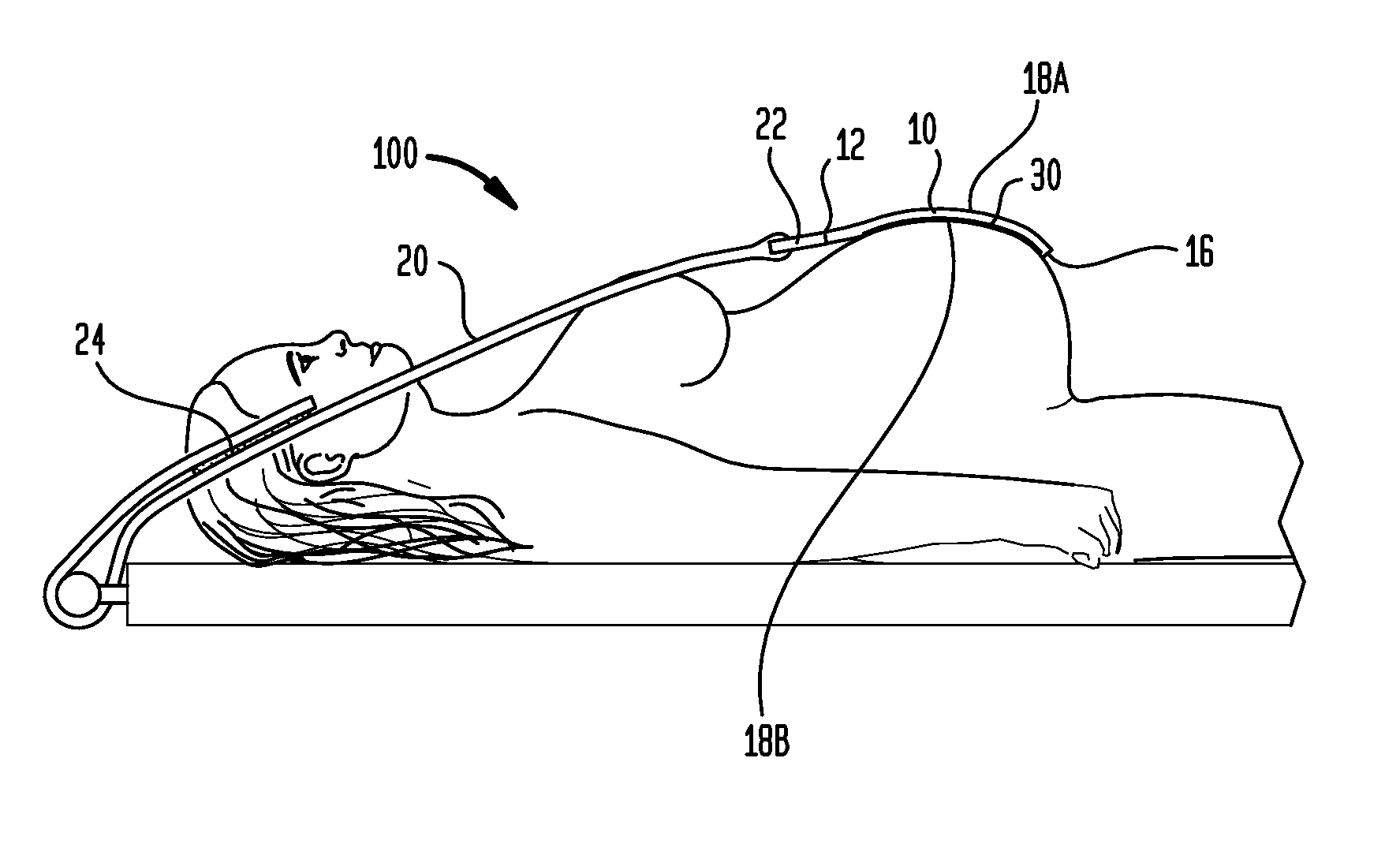 Abdominal elevator