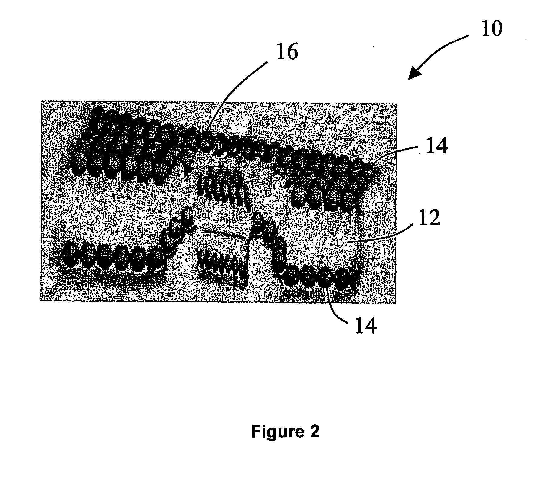 Apparatus and method of treatment utilizing a varying electromagnetic energization profile