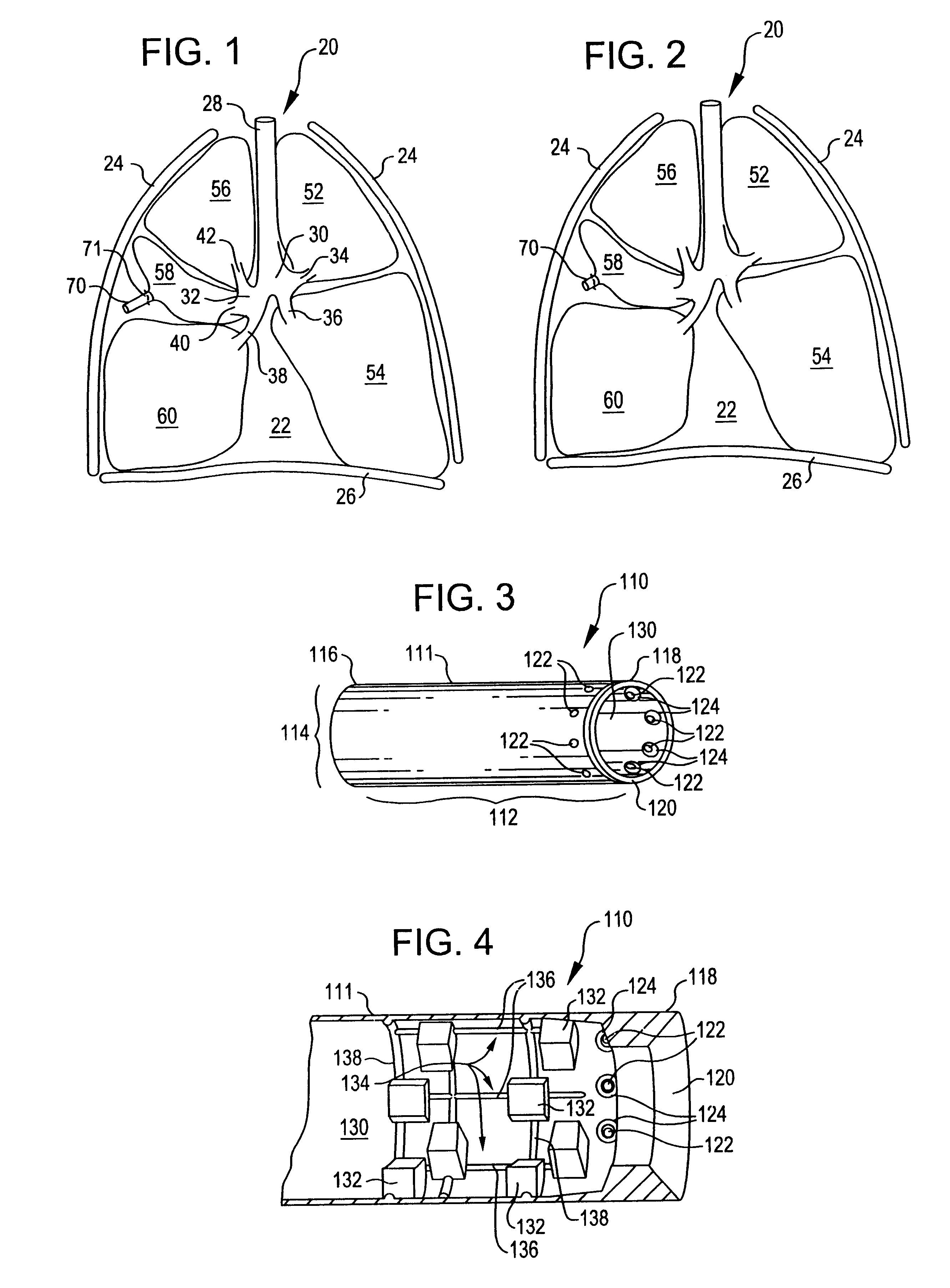 Constriction device including tear resistant structures