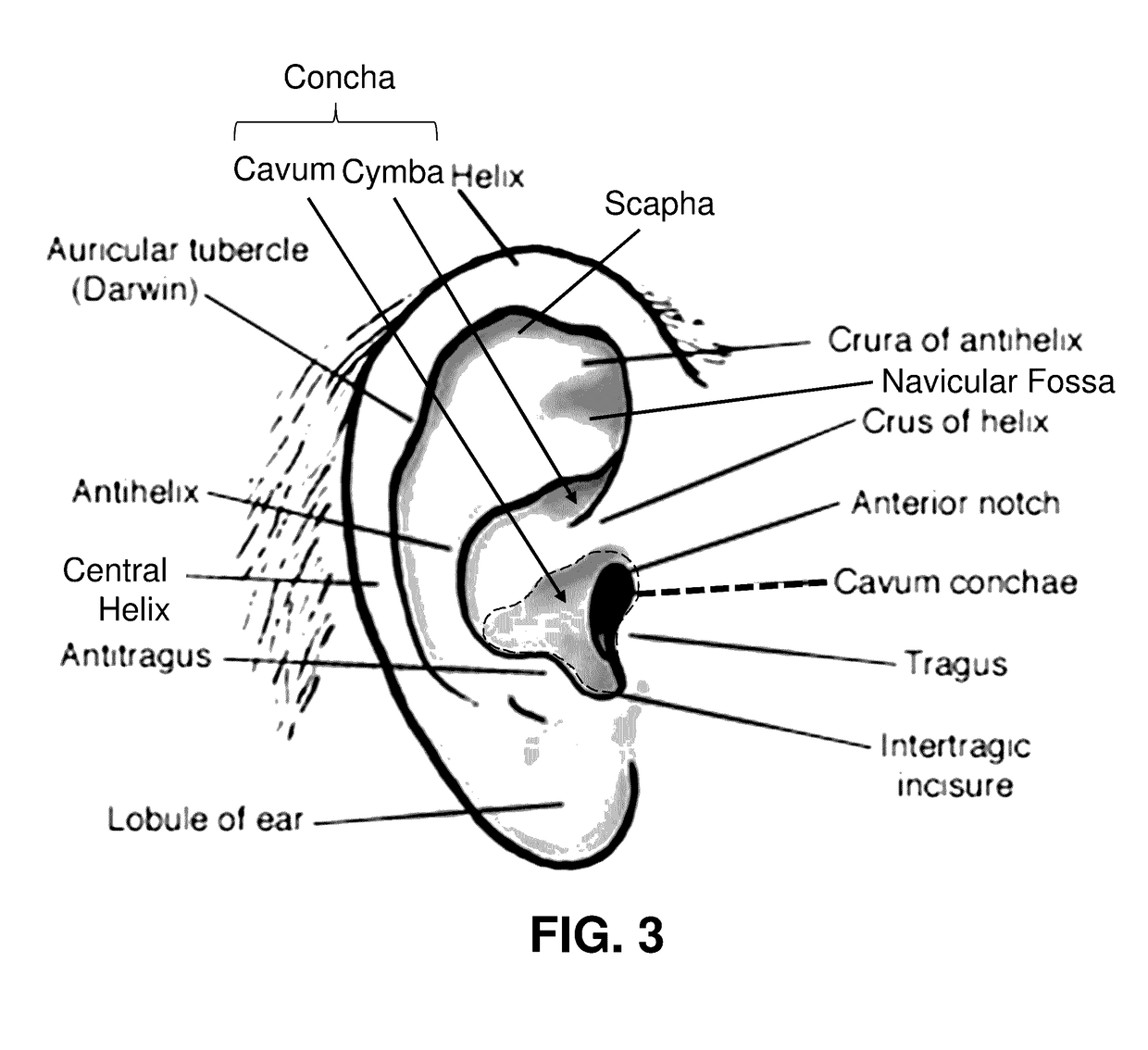 Transcutaneous electrostimulator and methods for electric stimulation