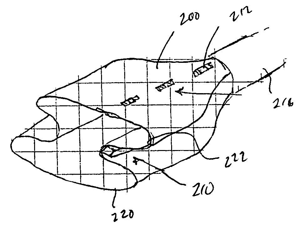 Endovascular graft with pressor and attachment methods