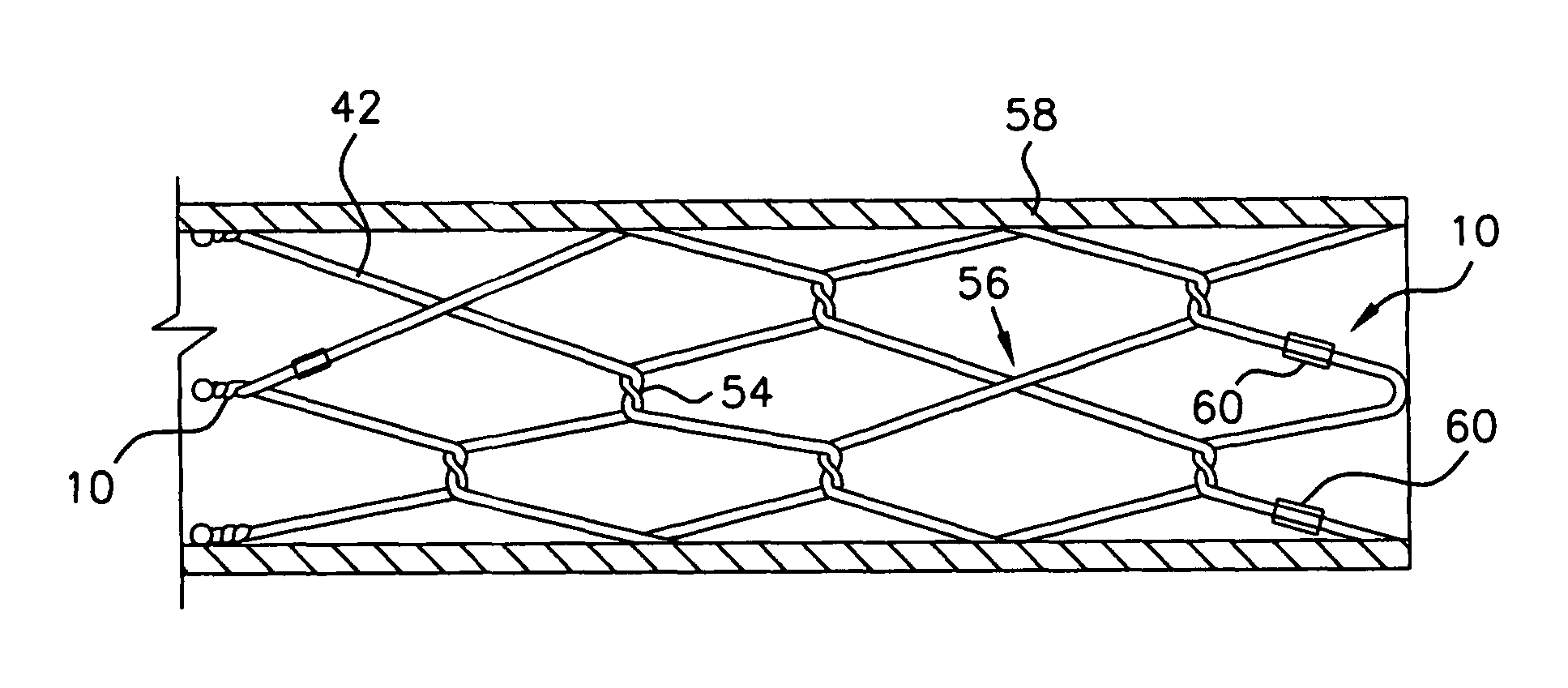 Low profile medical stent