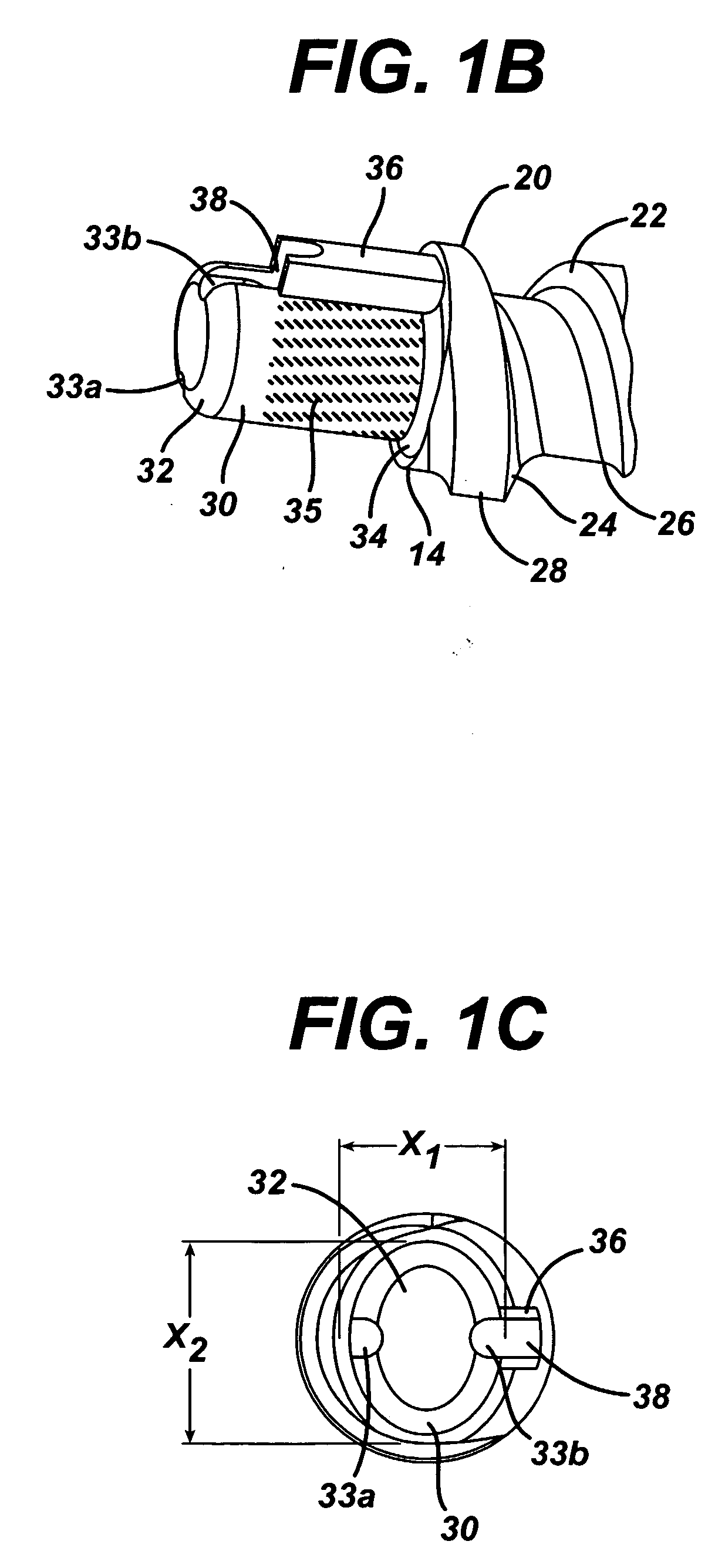 Suture anchor with improved torsional drive head