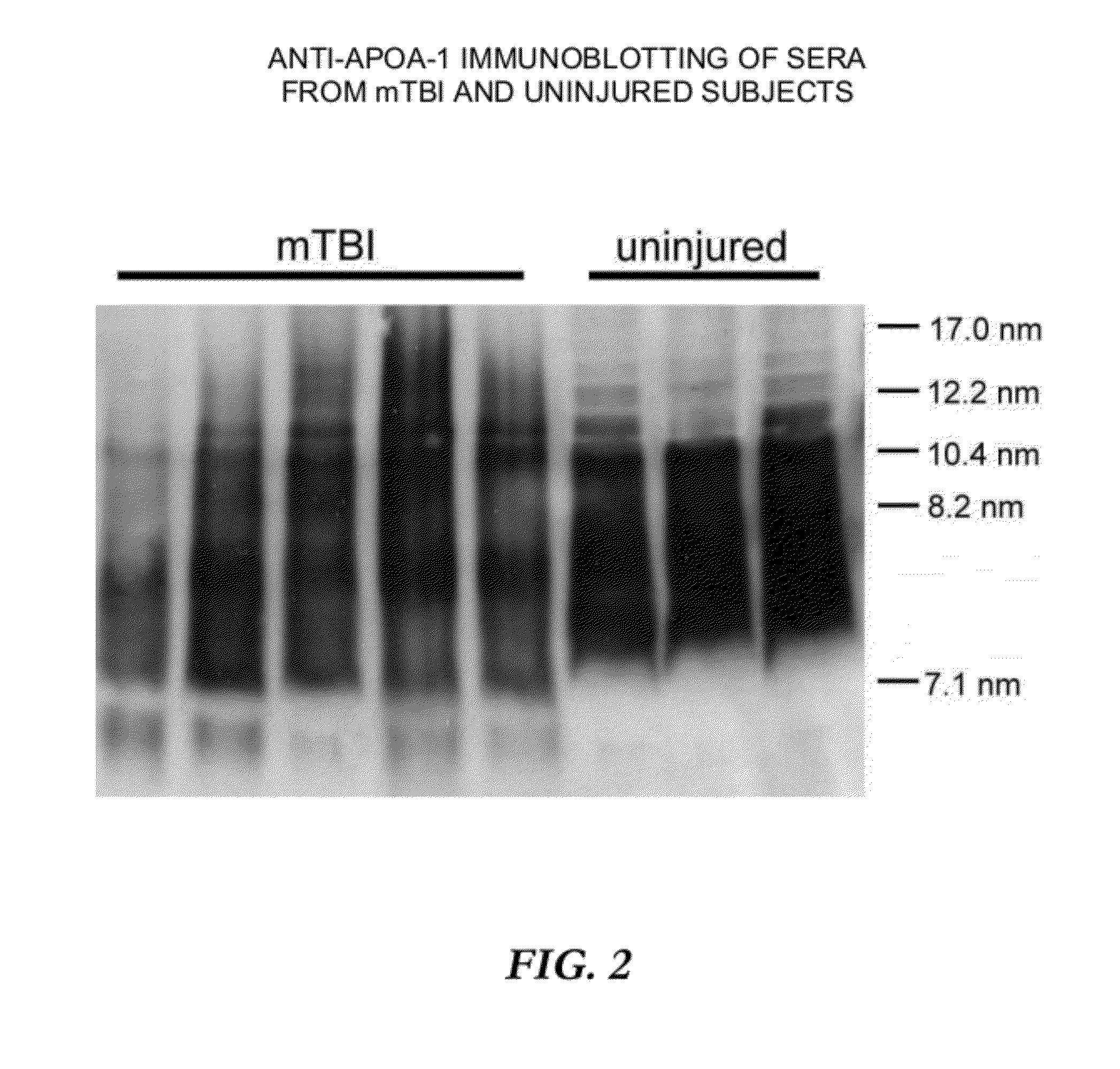 Method of diagnosing mild traumatic brain injury