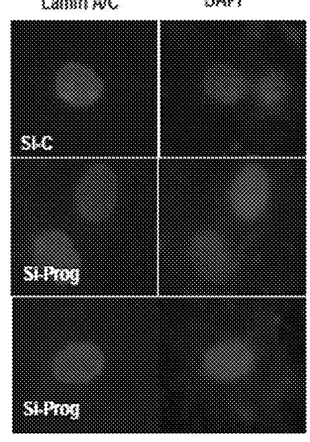 Pharmaceutical composition for treating aging-associated diseases, containing progerin expression inhibitor as active ingredient, and screening method of said progerin expression inhibitor