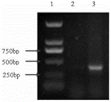 Preparation method of RBM5 FISH probe for lung cancer detection