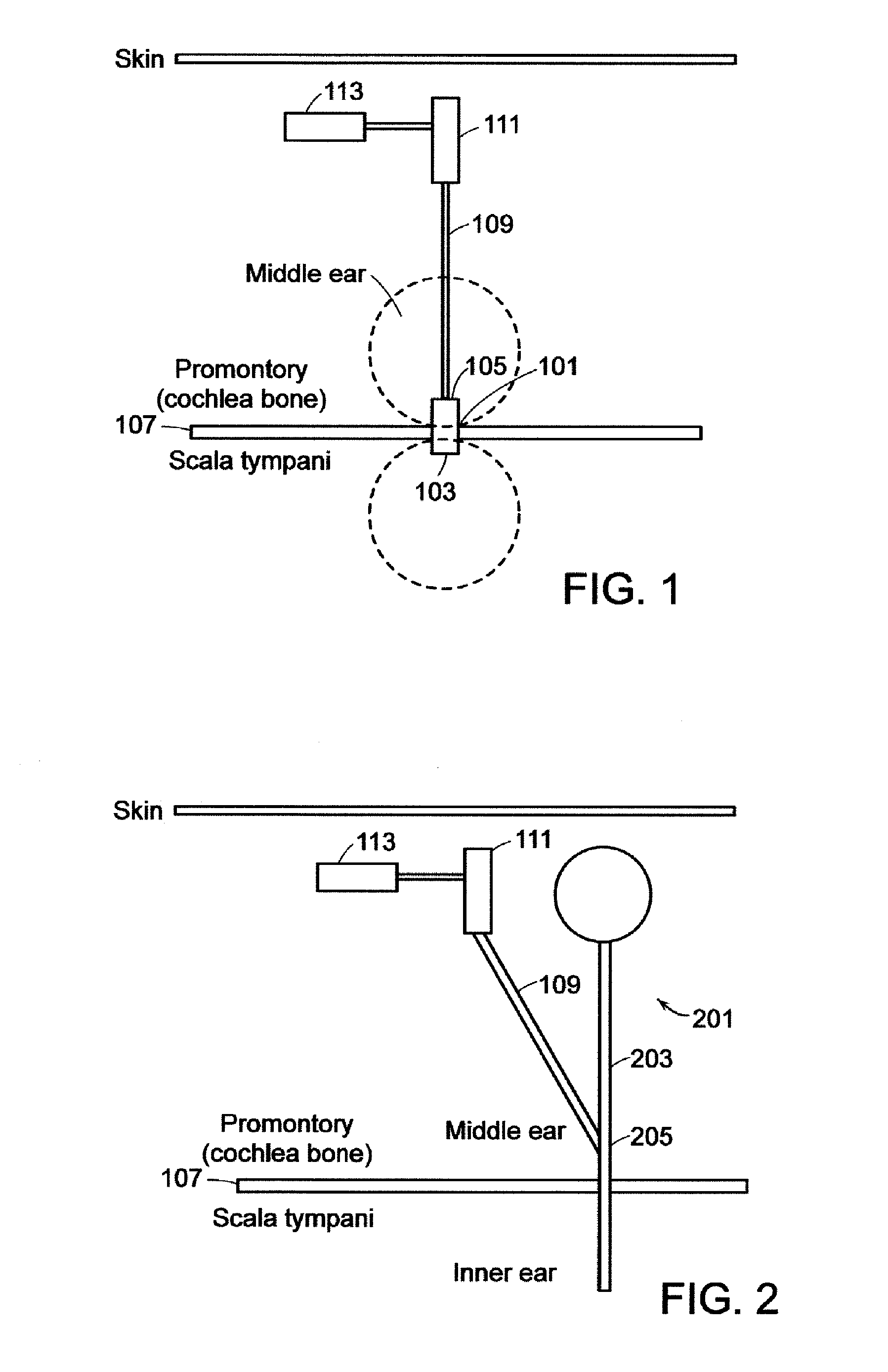 Implantable Neuro-Stimulation Electrode with Drug Elution Material