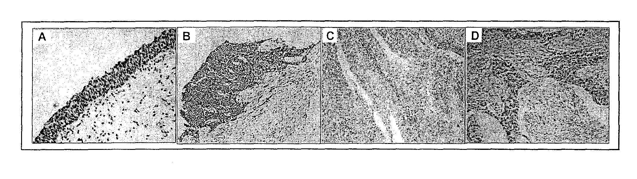 Methods for the Treatment of Cancers